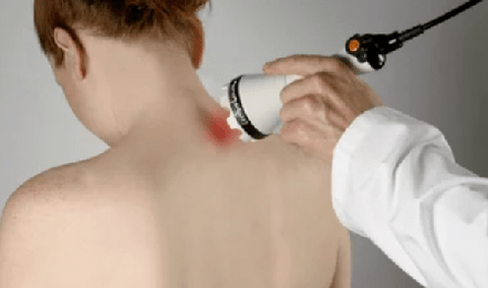 Tratamento da osteocondrose cervical por fisioterapia