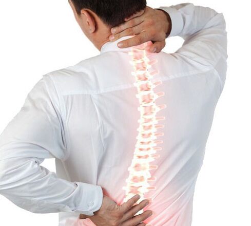 Osteocondrose da columna vertebral nun home
