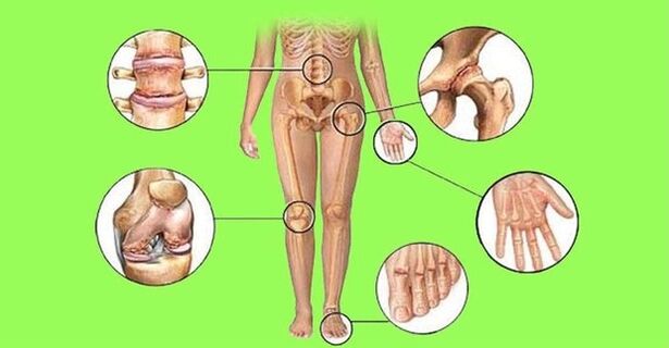 articulacións afectadas por artrite e artrose